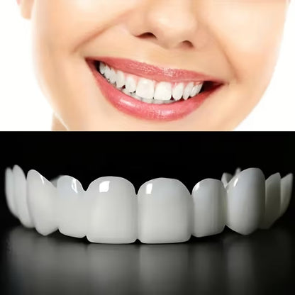 Carillas Dentales Snap Smile